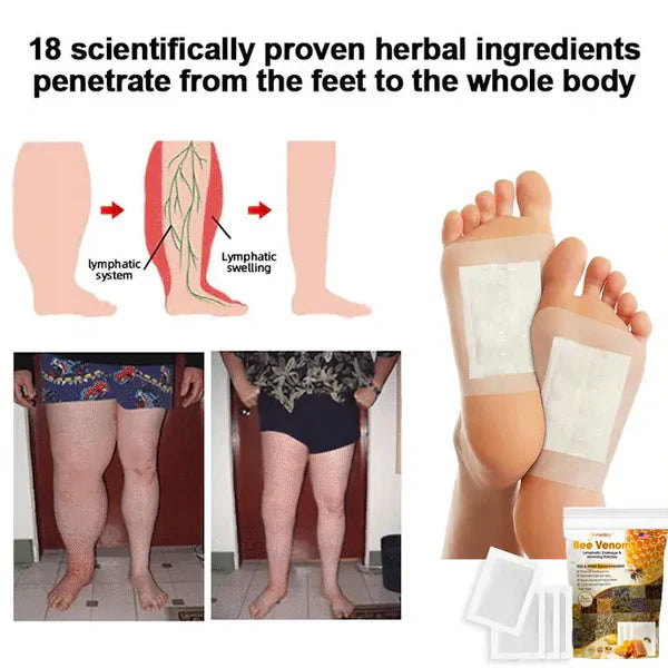 Bee Venom Lymphatic Drainage & Slimming Foot Patches (BUY 1 GET 1 FREE)